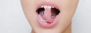 Complicaciones después de la perforación de la lengua