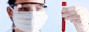 Reemplazo permanente del diente en pacientes diabéticos Los carbohidratos y una tiroides de bajo funcionamiento: lo que usted necesita saber acerca de los carbohidratos en una dieta hipotiroidea