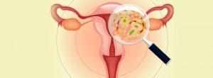 El dolor después de la micción no siempre es una señal de una enfermedad de transmisión sexual en los hombres ¿Qué podría estar causando su picazón vaginal?