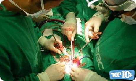 Cirugía de Corazón Abierto-entre-cirujias-mas-caras-del-mundo 