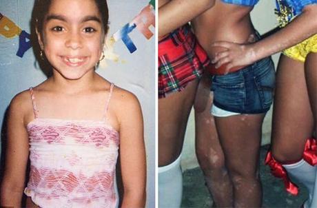 Después de ser Diagnosticada con Vitiligo, esta muchacha ahora adulta da vuelta a su cuerpo con un arte asombroso.