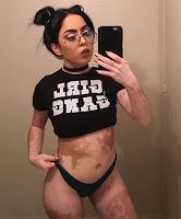 Después de ser Diagnosticada con Vitiligo, esta muchacha ahora adulta da vuelta a su cuerpo con un arte asombroso.