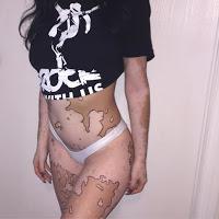 Después de ser Diagnosticada con Vitiligo, esta muchacha ahora adulta da vuelta a su cuerpo con un arte asombroso.