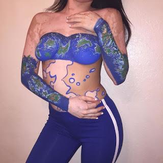 Después de ser Diagnosticada con Vitiligo, esta muchacha ahora adulta da vuelta a su cuerpo con un arte asombroso.