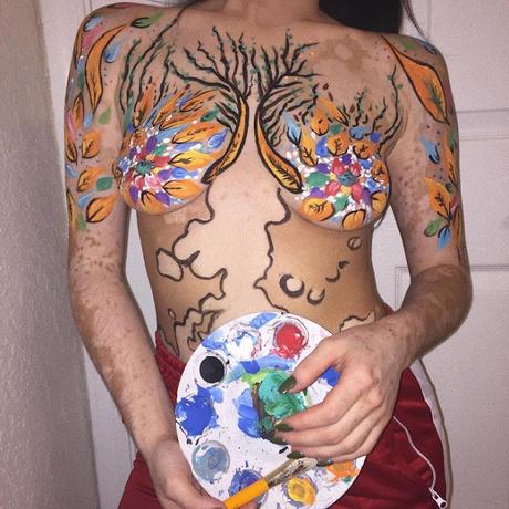 Después de ser Diagnosticada con Vitiligo, esta muchacha ahora adulta da vuelta a su cuerpo con un arte asombroso.