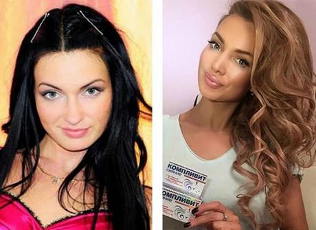 10 Hermosas mujeres Rusas antes y después de una mala sirujia plastica.