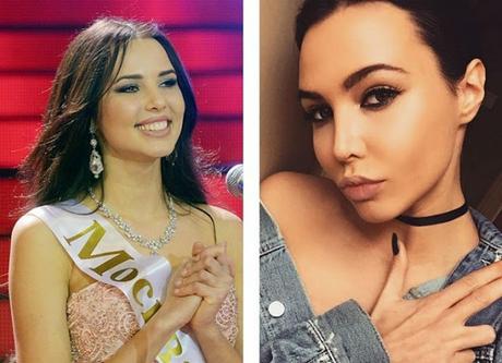 10 Hermosas mujeres Rusas antes y después de una mala sirujia plastica.