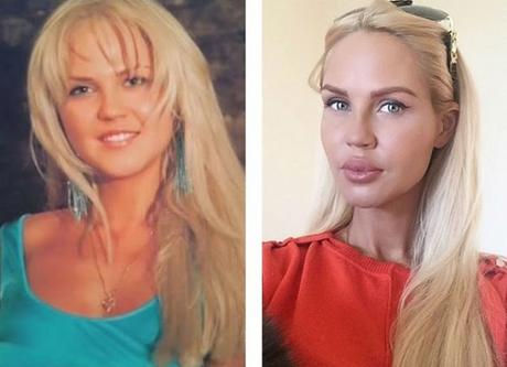 10 Hermosas mujeres Rusas antes y después de una mala sirujia plastica.