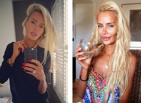 10 Hermosas mujeres Rusas antes y después de una mala sirujia plastica.