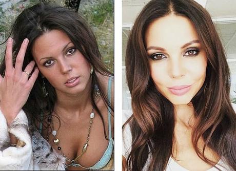 10 Hermosas mujeres Rusas antes y después de una mala sirujia plastica.