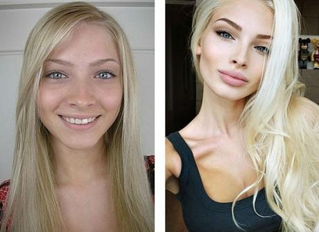 10 Hermosas mujeres Rusas antes y después de una mala sirujia plastica.