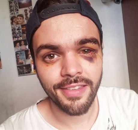 “Pensé que me mataban” El joven ya fue dado de alta y mejora día a día