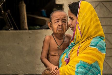 El verdadero caso Benjamin Button (LA HISTORIA FOTO)