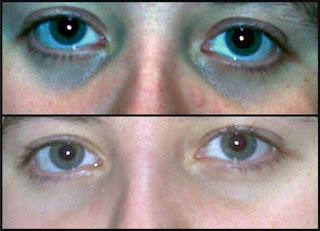 Día 531: Contorno de ojos, PRAXIS.