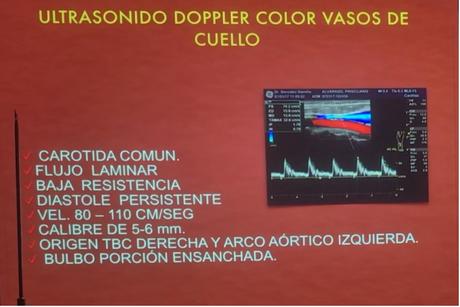 Características Doppler de la arteria carotida comun