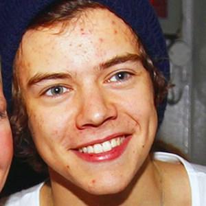 Como Quitar El Acne Dela Frente Rapidamente Como Quitar El Acne Dela Frente Rapidamente