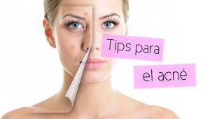 Como Eliminar El Acne Rapido Con Remedios Caseros