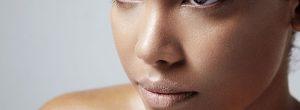 Opciones actuales de tratamiento para el acné vulgar