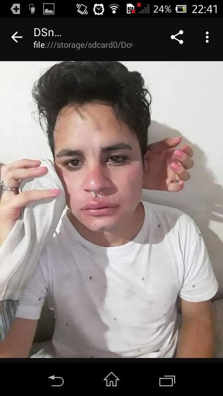 Leonel Campos víctima de un brutal ataque por ser gay