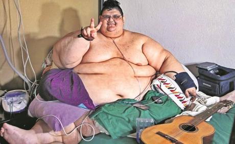 Fotos de obesidad mórbida y casos célebres de superobesos