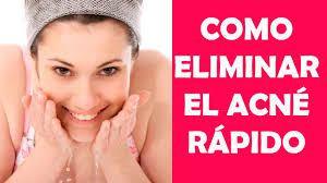 Como Eliminar El Acne Rapido: Los Metodos Correctos
