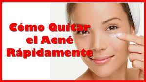 Mejores Metodos Caseros Para Eliminar El Acne