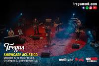 Concierto Tregua en Utopic Us