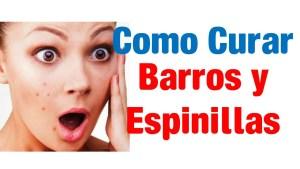 Como Quitar Barros Rapido y Facil