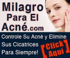 Con Que Se Puede Quitar El Acne – Aquí La Respuesta Paso a Paso Con Que Se Puede Quitar El Acne – Aquí La Respuesta Paso a Paso