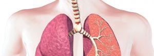 Bronquitis: causas, síntomas y tratamiento