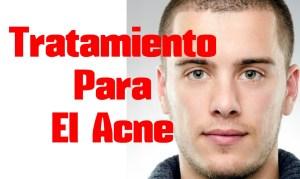 Como Quitar Rapidamente El Acne – Algunos Remedios Caseros Como Quitar Rapidamente El Acne – Algunos Remedios Caseros