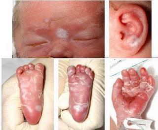 Infecciones congénitas: actualización Infecciones congénitas: actualización