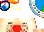 Cuba, mayor envejecimiento menor fertilidad