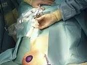 Tecnología última generación para cáncer piel