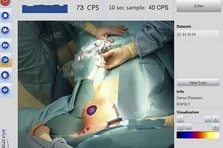 Tecnología de última generación para el cáncer de piel