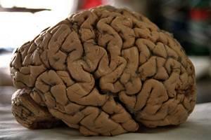 Bravo por Ricardo Miledi y Dau