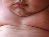 obesidad también afecta bebés