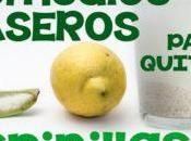 Remedios Caseros Para Quitar Espinillas Barros