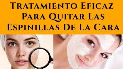 como quitar las espinillas remedios caseros Como Quitar Las Espinillas Con Remedios Caseros