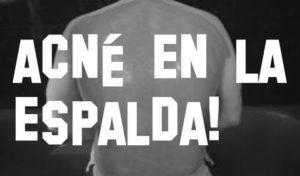 Como Quitar Barros De La Espalda?