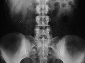 Anatomia radiologica glandulas suprarrenales.
