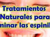 Como Sacar Barros Espinillas