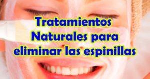Como Sacar Barros y Espinillas