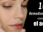 Remedios Naturales Para Acne Debes Probar
