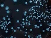 Sintomas legionella