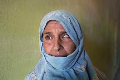 Visiones saharauis (3): Mutilados en el Sáhara