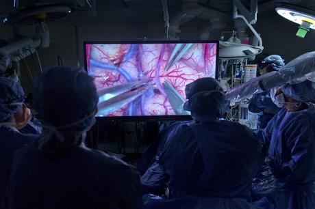 La cirugía del cerebro del futuro será en 3D