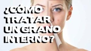 Como Quitar Los Granos Ciegos