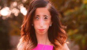 Noticia-4806-que-paso-con-la-mujer-mas-fea-del-mundo-su-cambio-dejara-boquiabierto-900