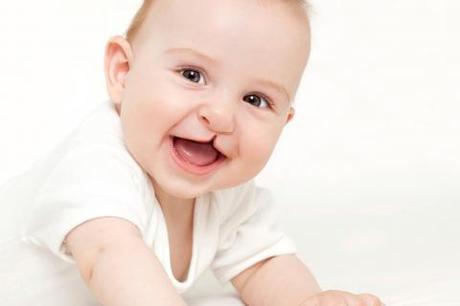 Labio leporino. Ácido fólico